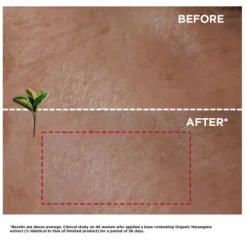 Clarins Moisturizers<Super Restorative Day Cream - Very Dry Skin